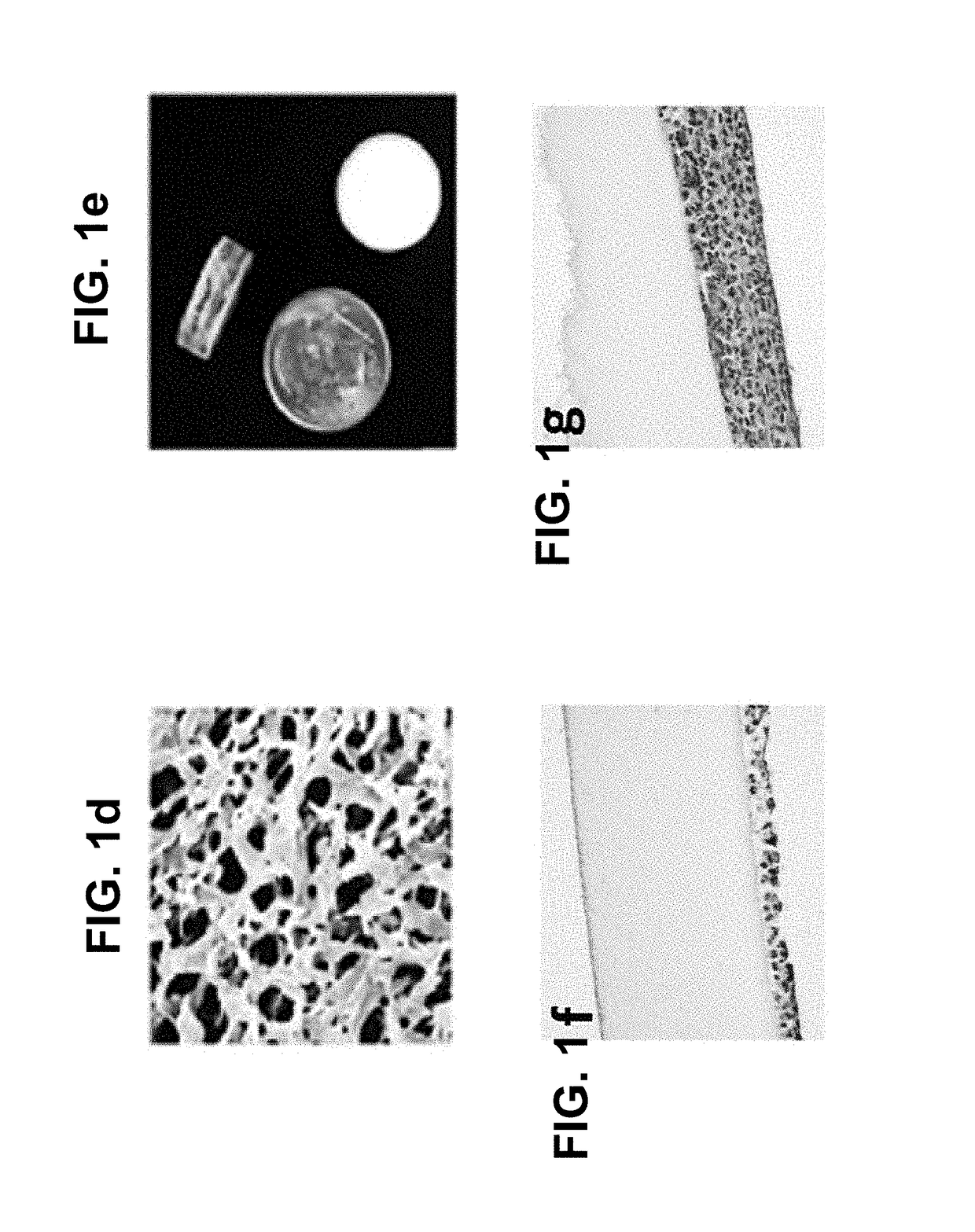 Methods and compositions for treating cancers using antisense