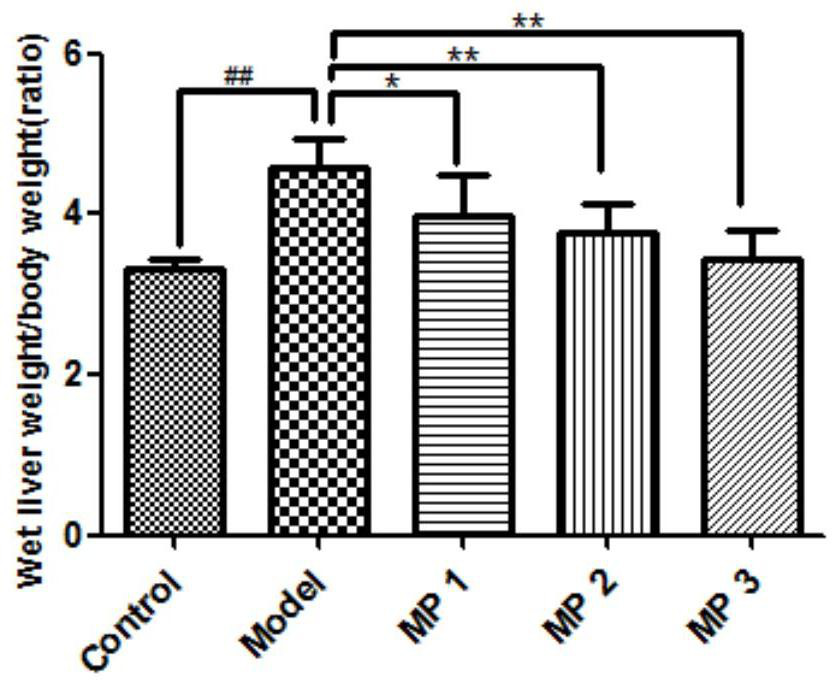 Application of methyl palmitate in preparation of drugs for preventing or treating fatty liver