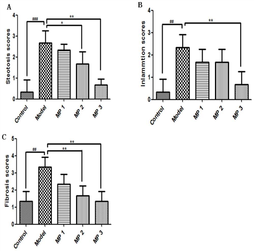 Application of methyl palmitate in preparation of drugs for preventing or treating fatty liver