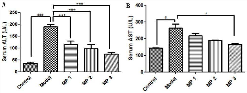 Application of methyl palmitate in preparation of drugs for preventing or treating fatty liver