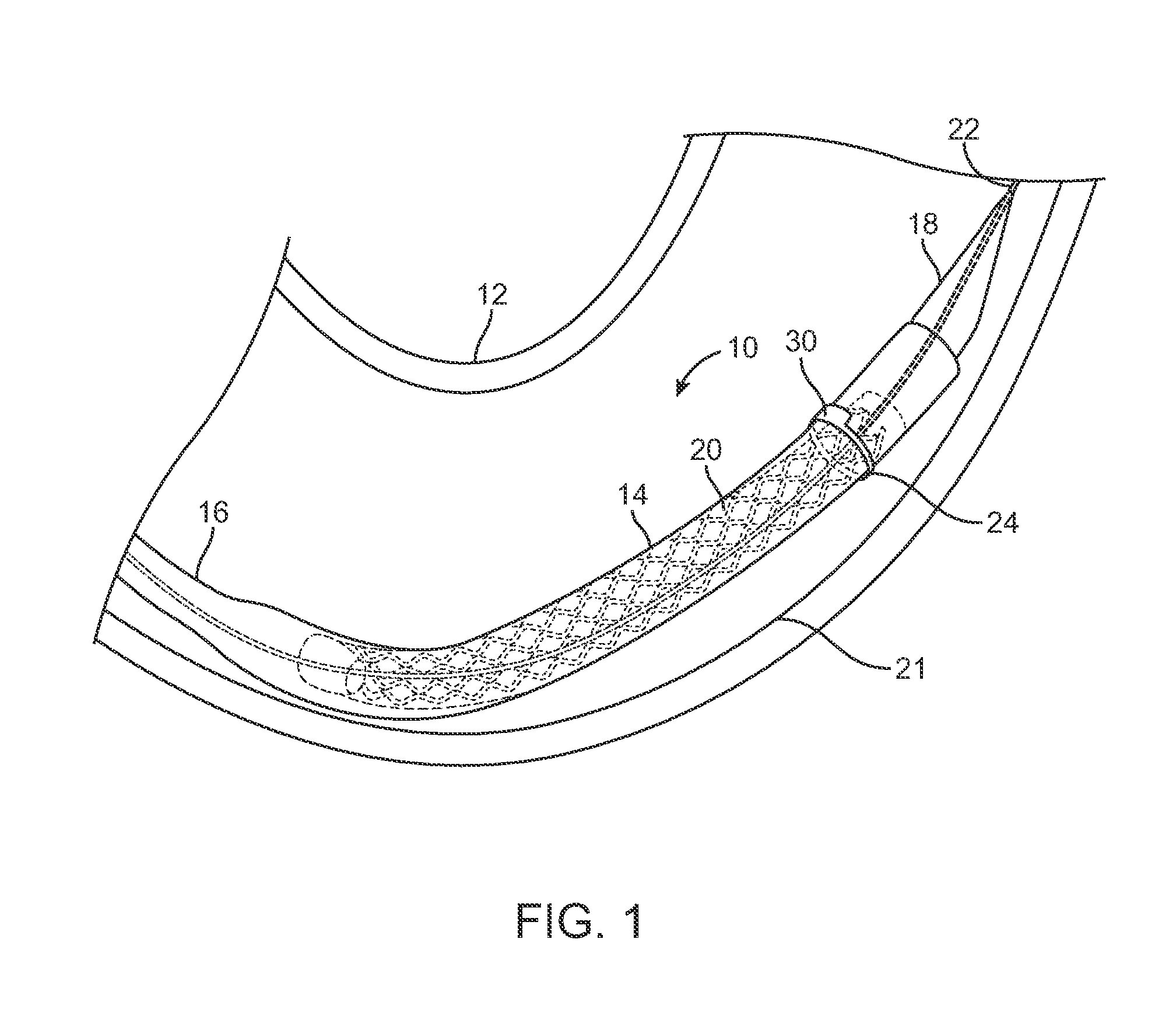 Medical device delivery systems and methods of use thereof