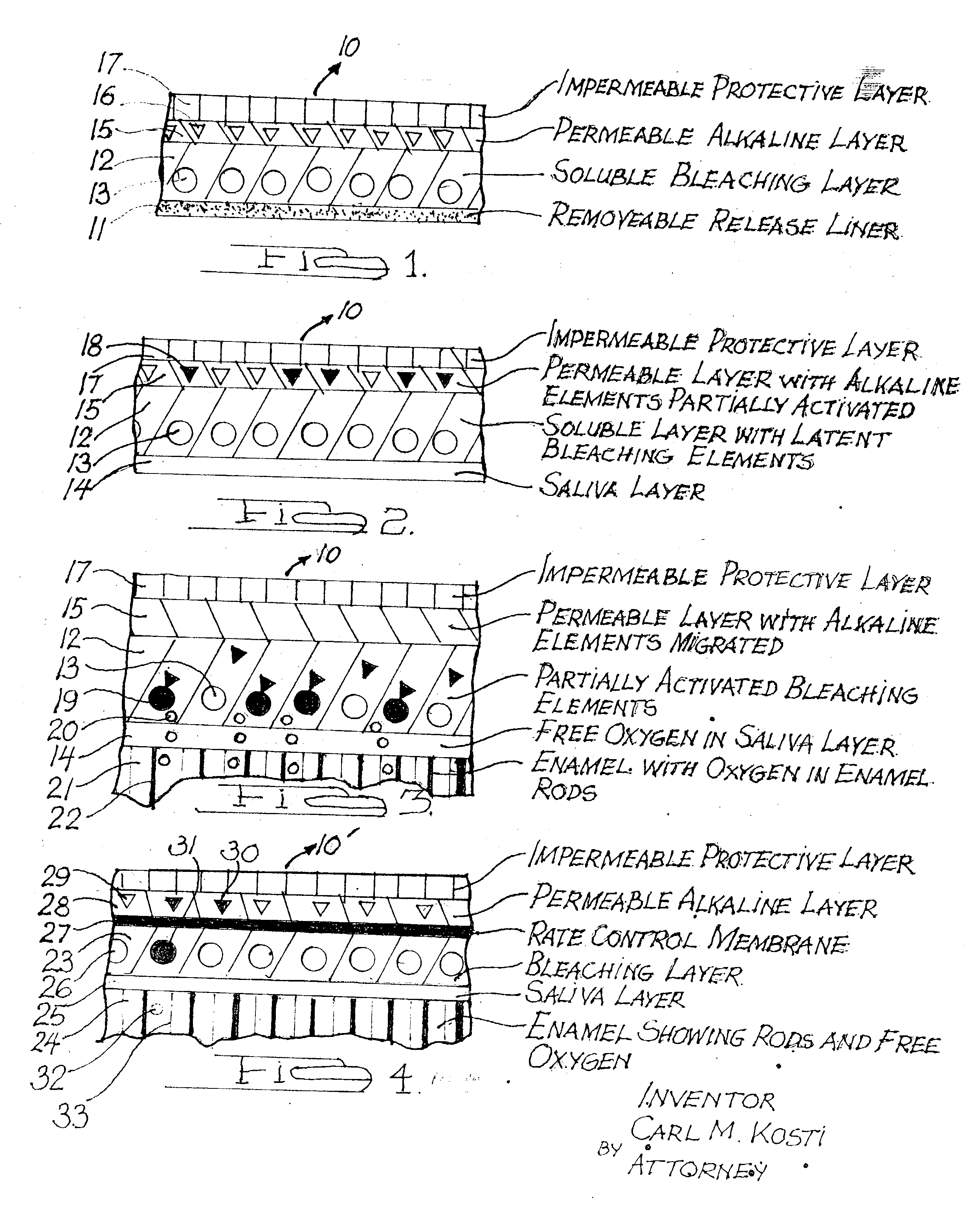 Multi-layer transenamel bleaching system