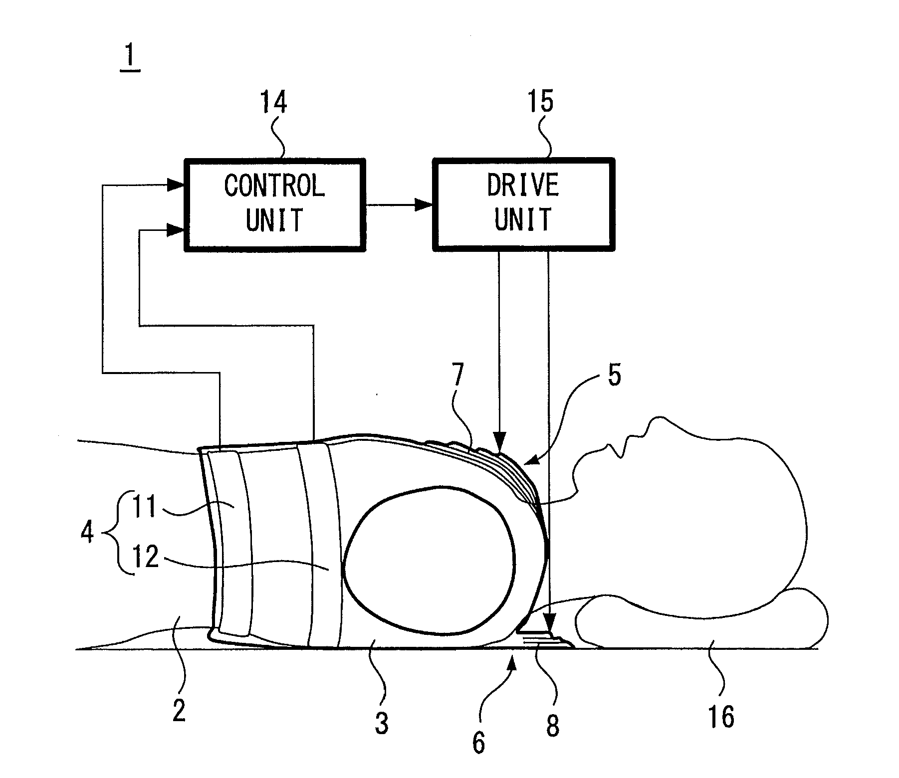 Airway-opening device