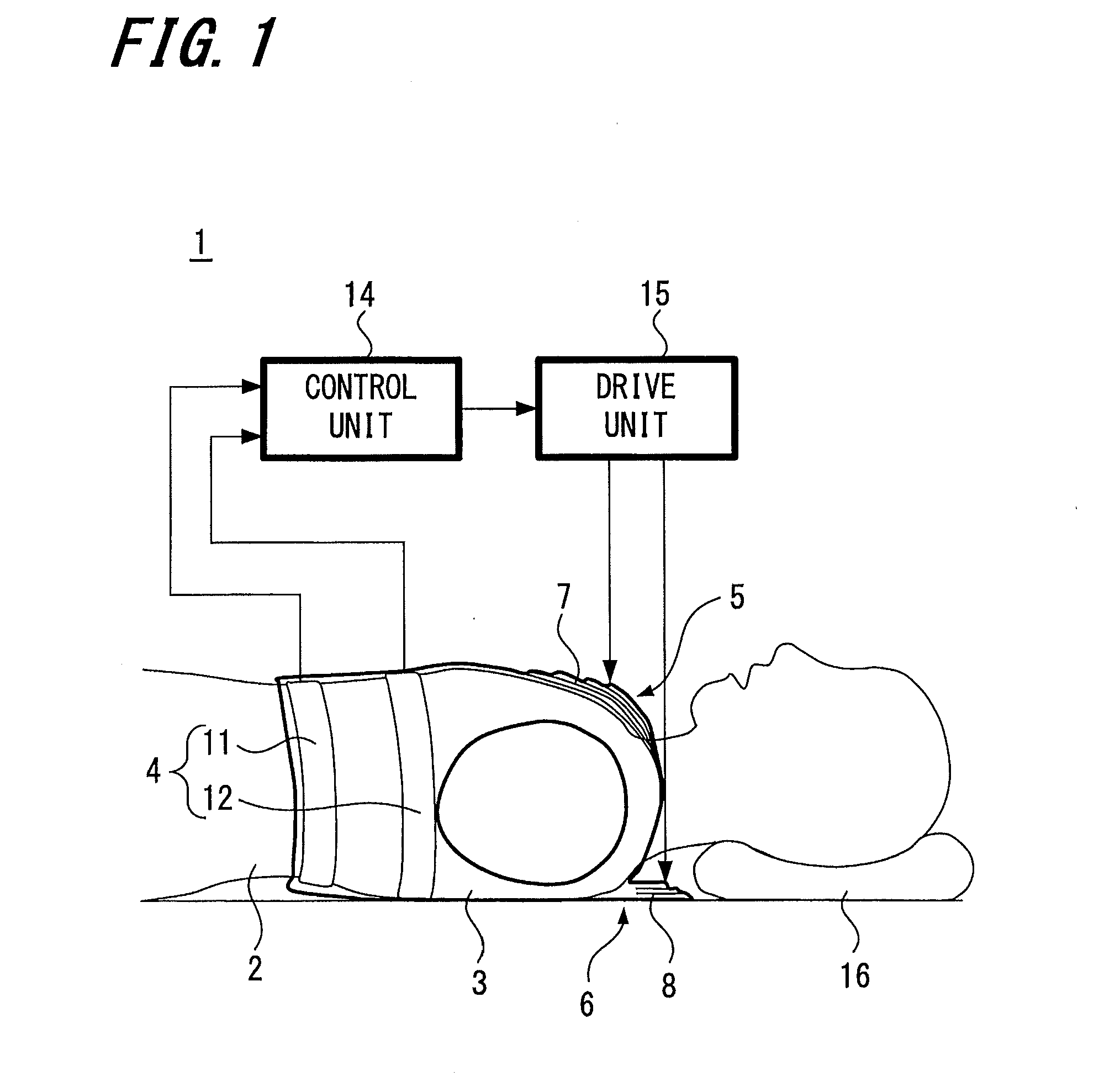 Airway-opening device