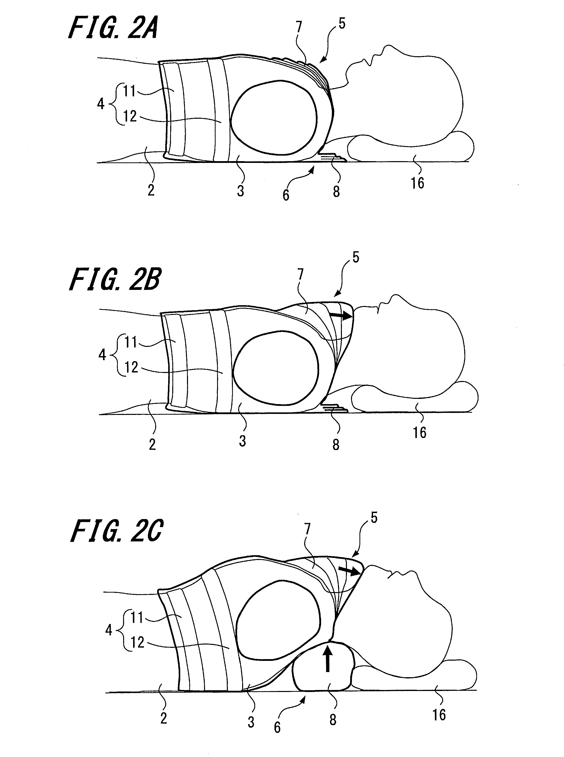 Airway-opening device