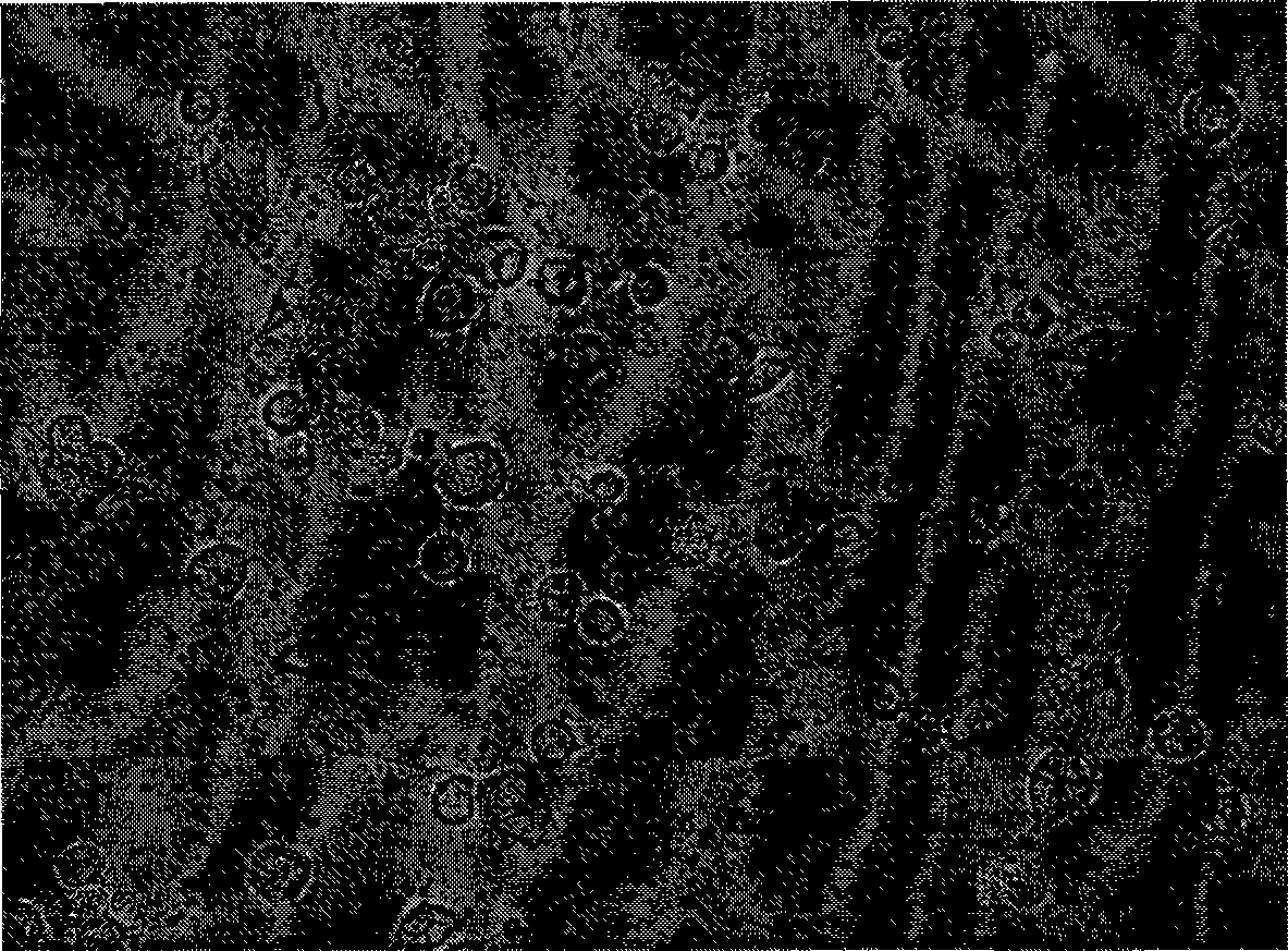 Herpes simplex virus vector, recombinant virus, host cell and pharmaceutical composition thereof