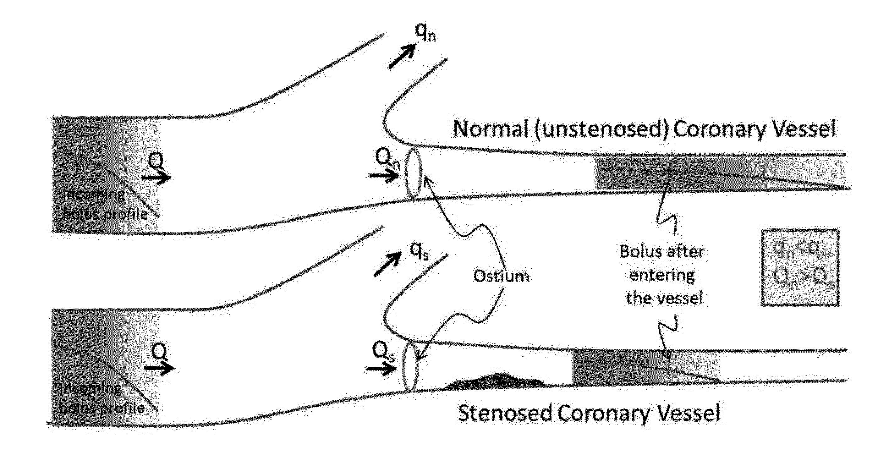 Method for Estimating Flow Rates, Pressure Gradients, Coronary Flow Reserve, and Fractional Flow Reserve from Patient Specific Computed Tomography Angiogram-Based Contrast Distribution Data