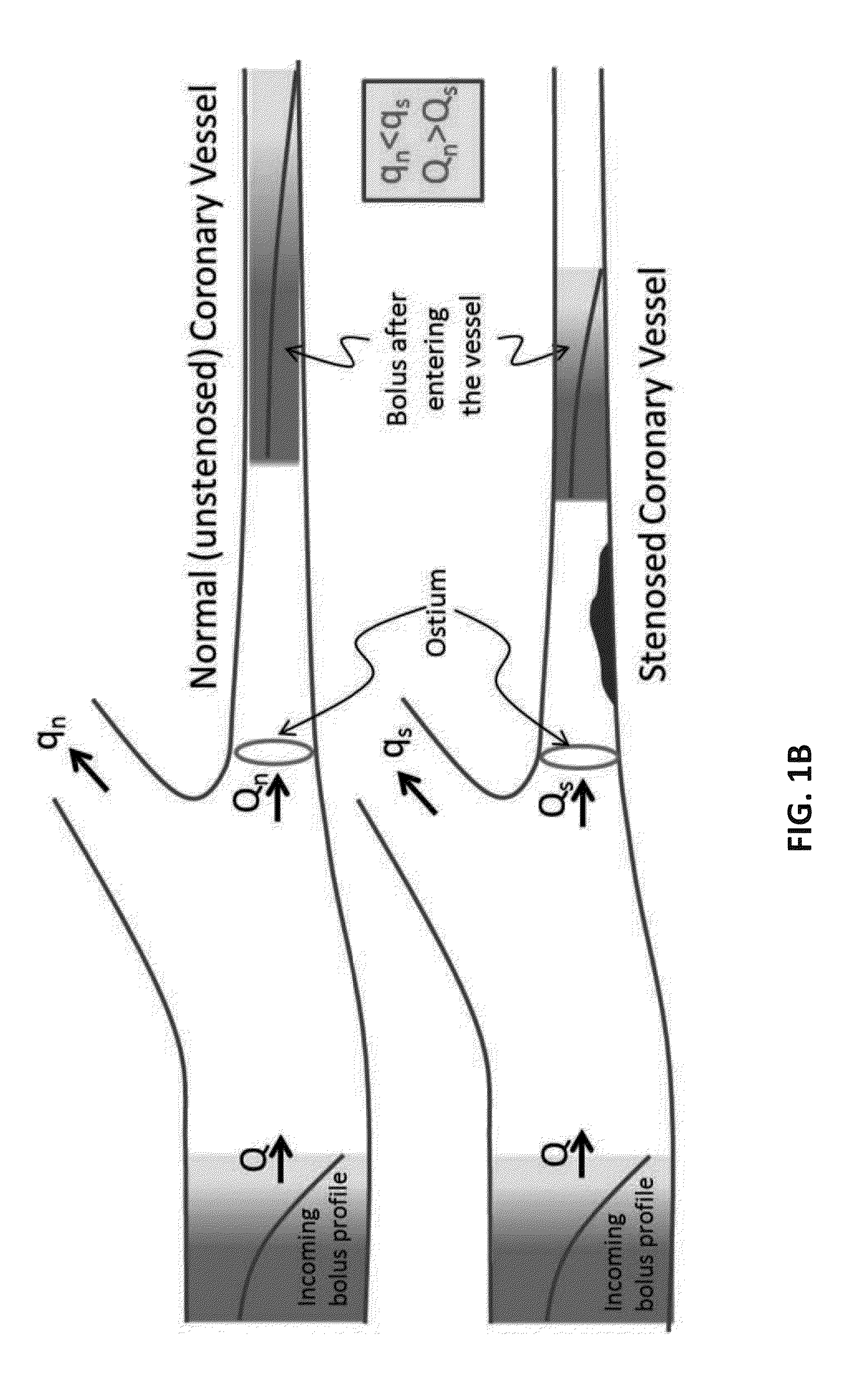 Method for Estimating Flow Rates, Pressure Gradients, Coronary Flow Reserve, and Fractional Flow Reserve from Patient Specific Computed Tomography Angiogram-Based Contrast Distribution Data