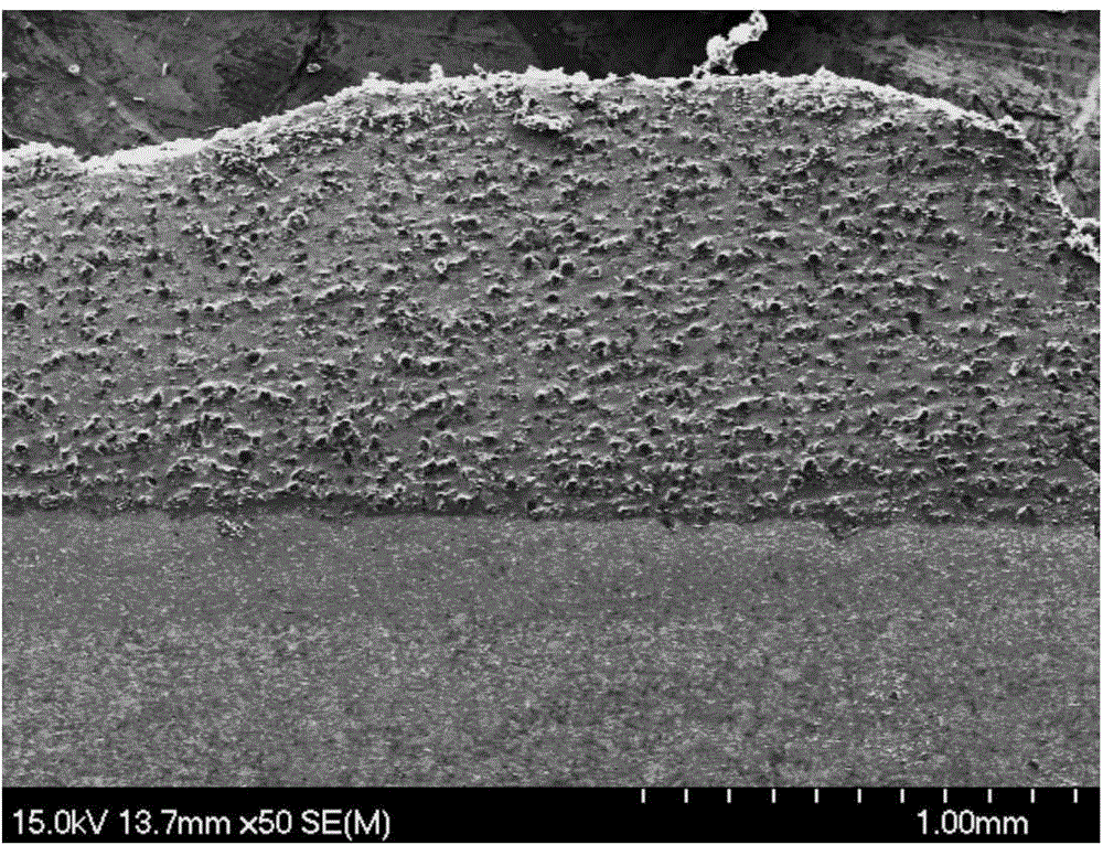 Metal-based/diamond laser composite coating and preparation method thereof