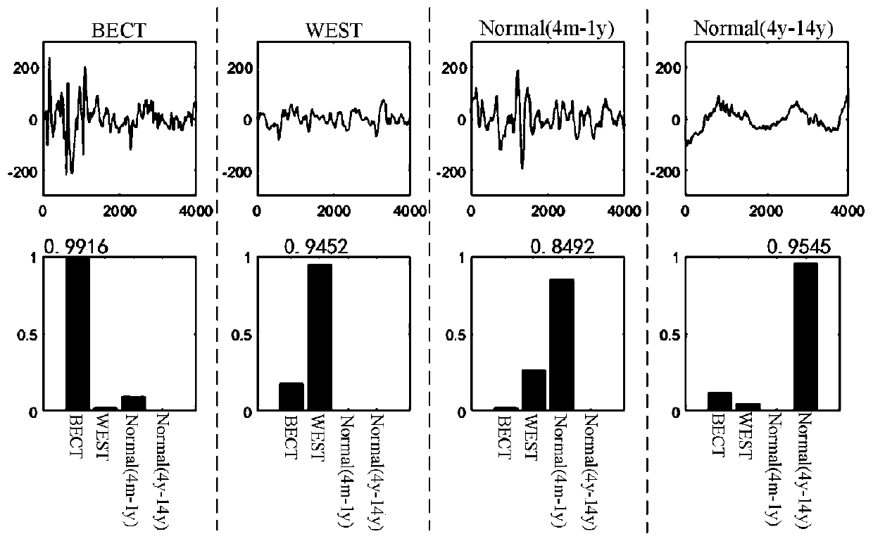 Children epilepsy syndrome classification method based on transfer learning multi-model decision fusion