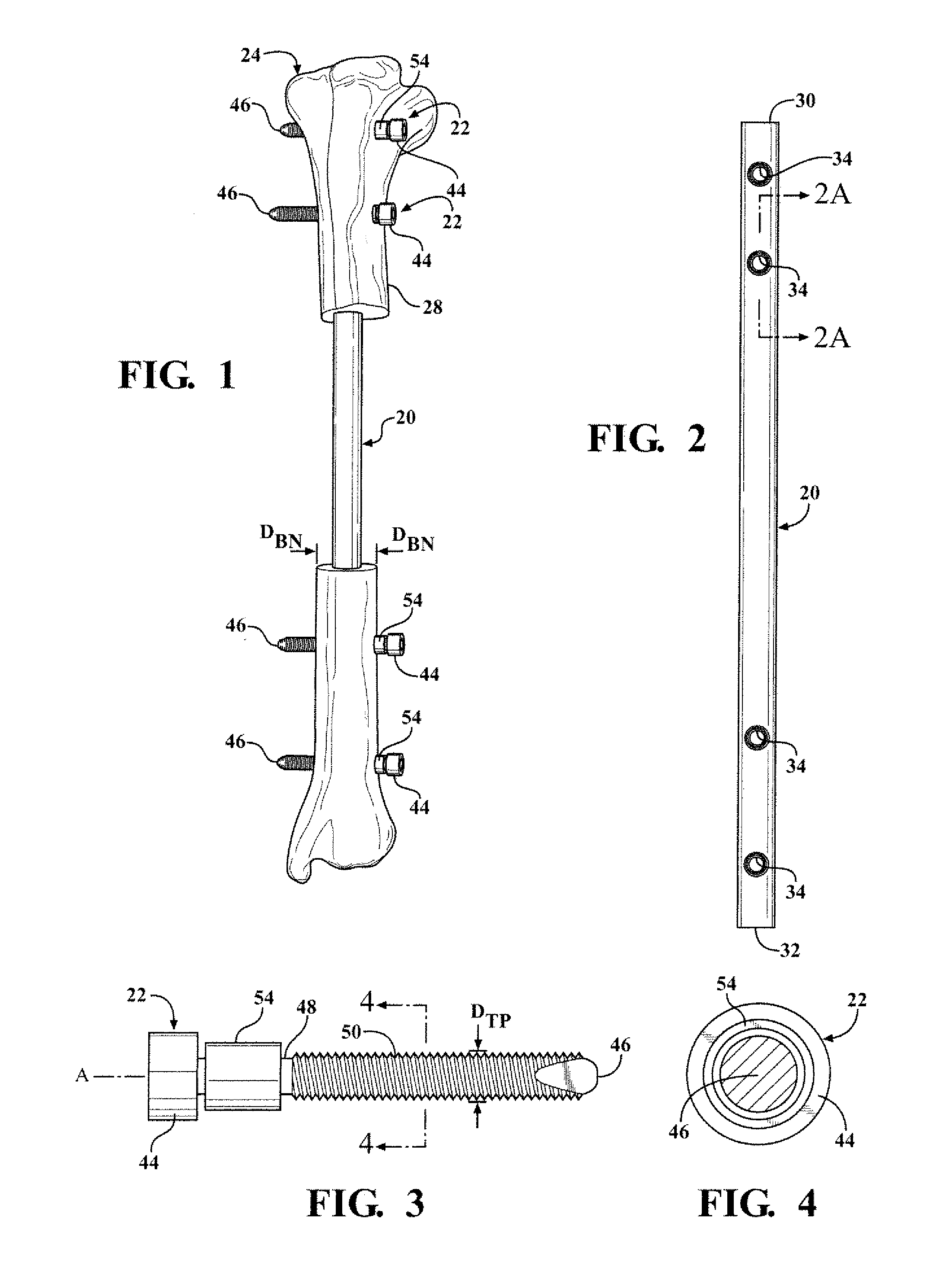 Easily implantable and stable nail-fastener for skeletal fixation and method