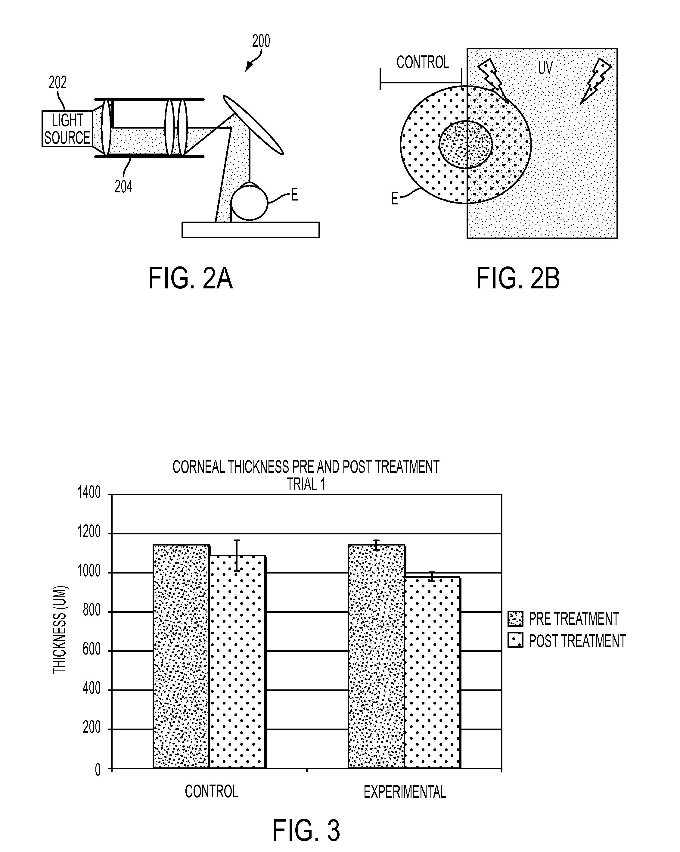 Aberration control by corneal collagen crosslinking combined with beam-shaping technique