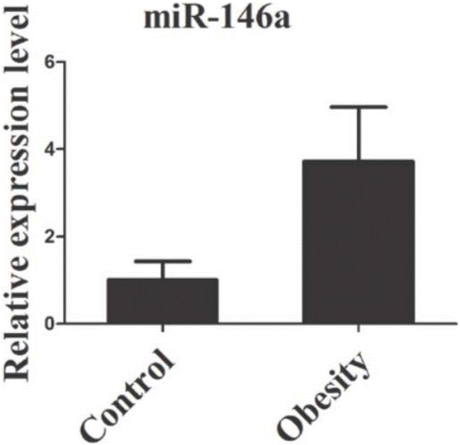 Childhood obesity-related serum or plasma miRNA markers and use thereof