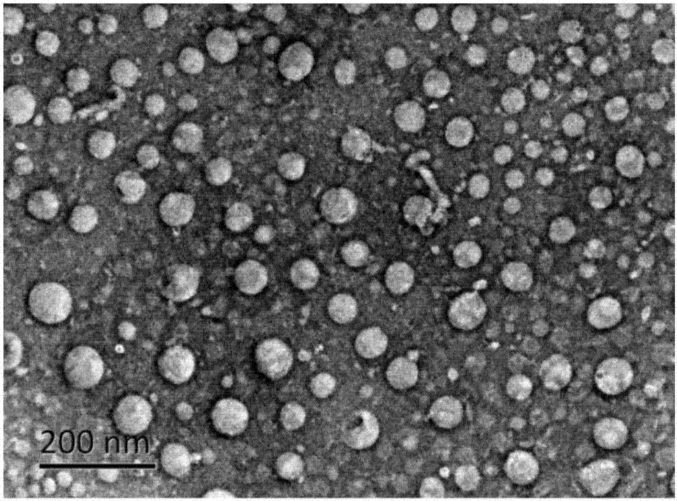 Preparation method of pluronic F127 curcumin liposome