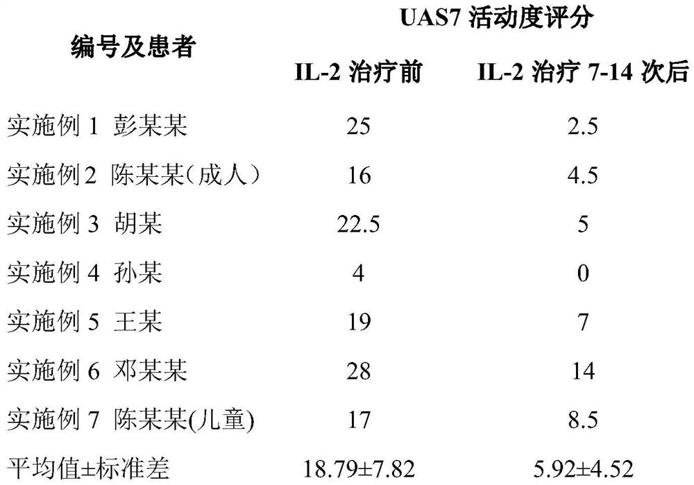 Application of interleukin 2 for treatment of chronic spontaneous urticaria