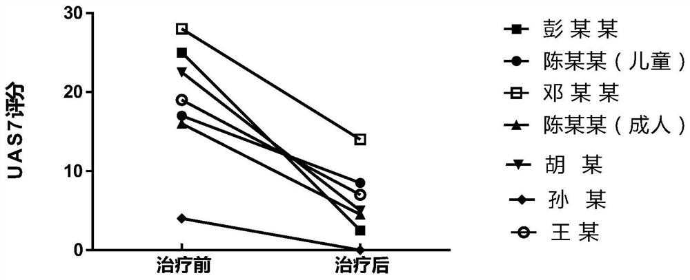 Application of interleukin 2 for treatment of chronic spontaneous urticaria