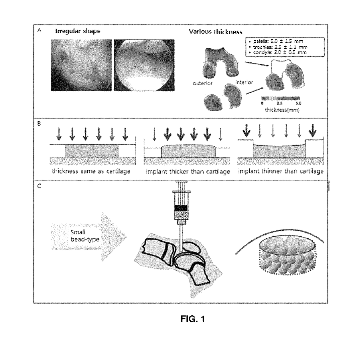 Preparation method for therapeutic agent of bead-type chondrocyte