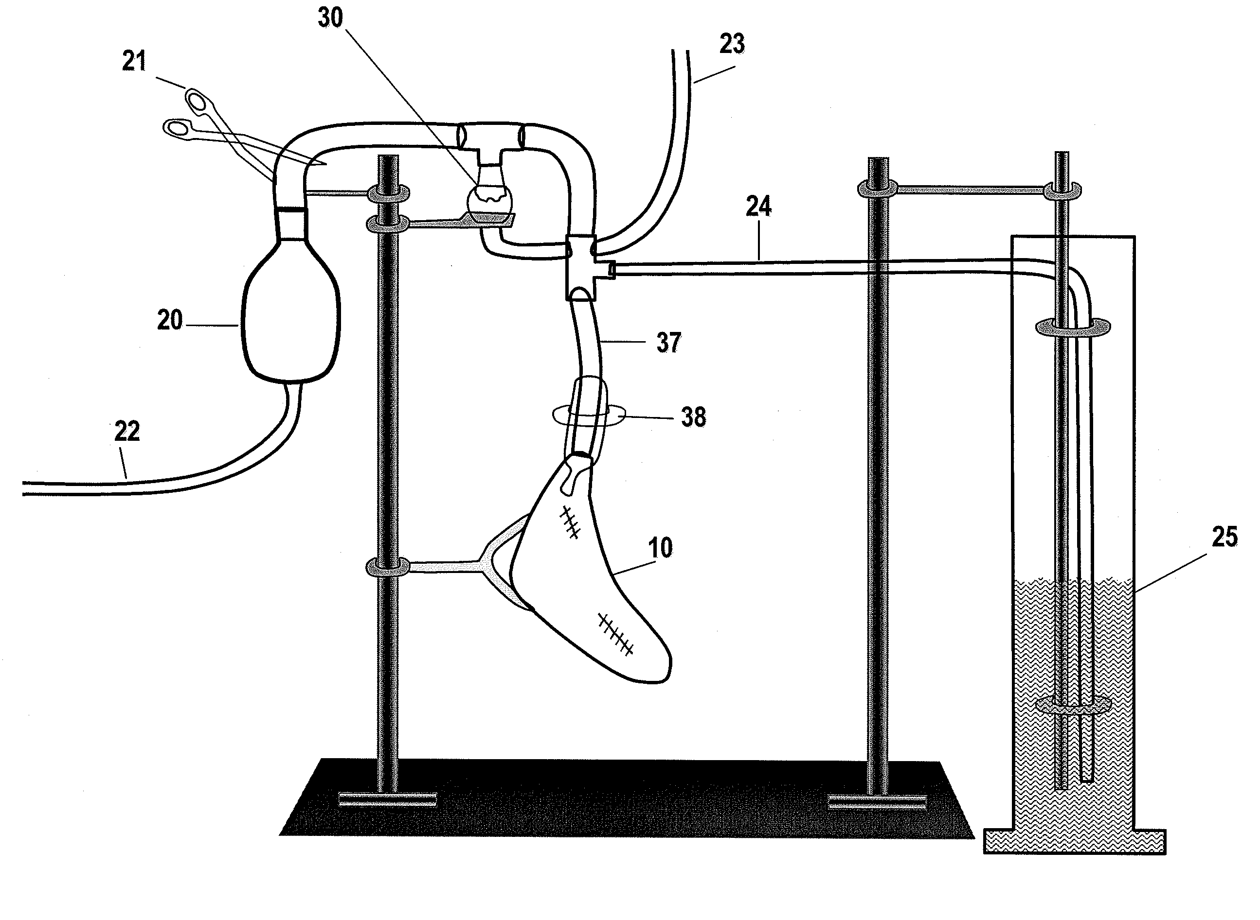 System and method for detection and repair of pulmonary air leaks