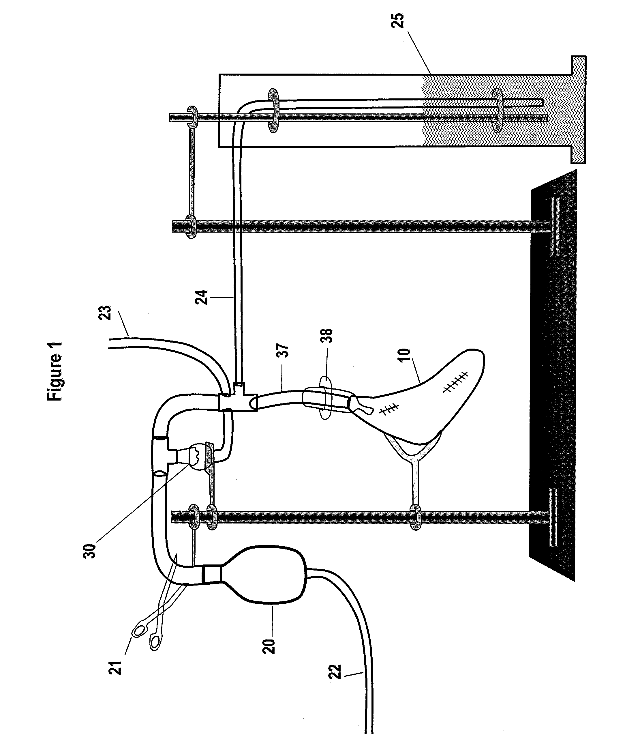 System and method for detection and repair of pulmonary air leaks