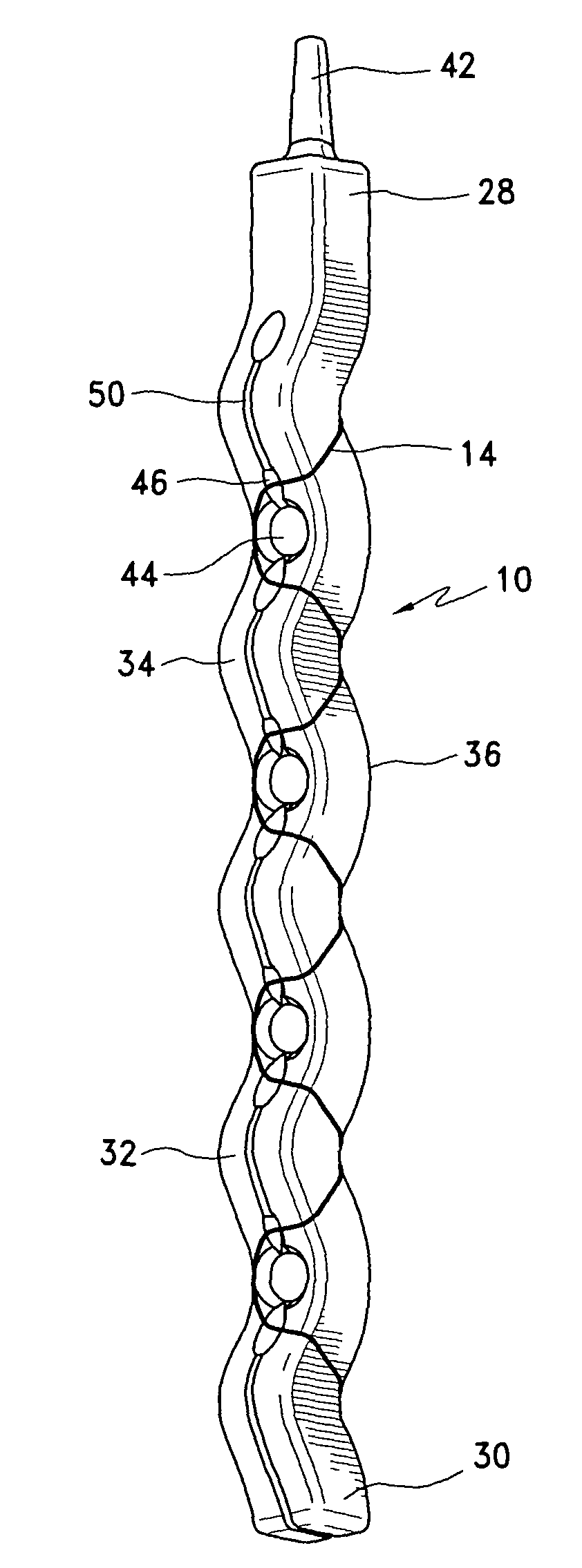 Apparatus for single pass gastric restriction