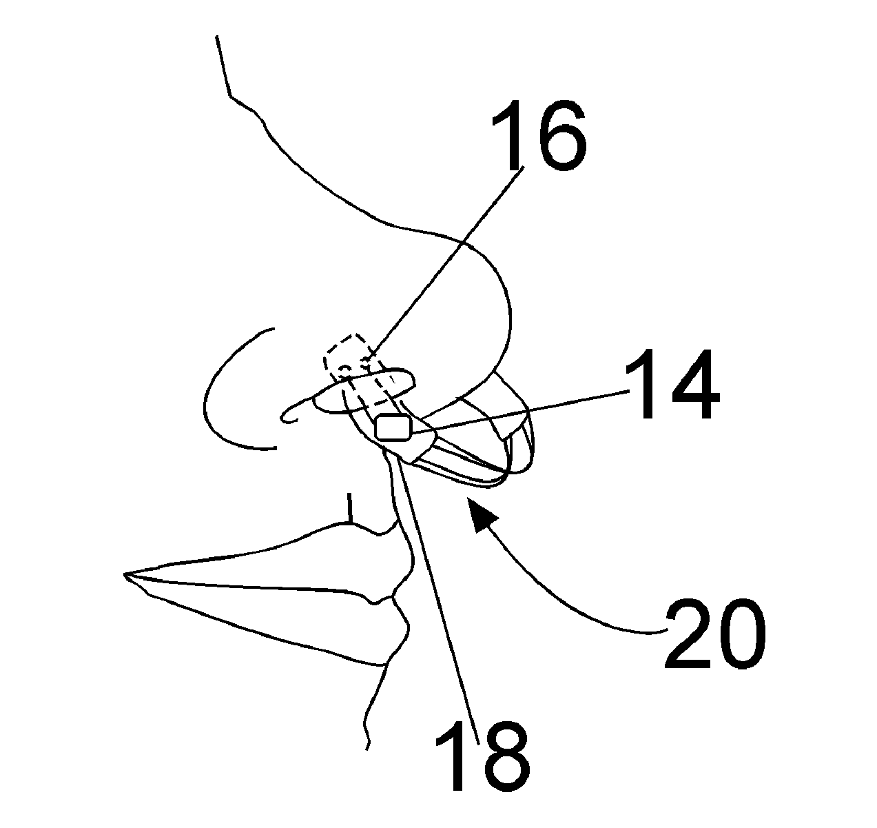 Nasal dilator combined with stimulator