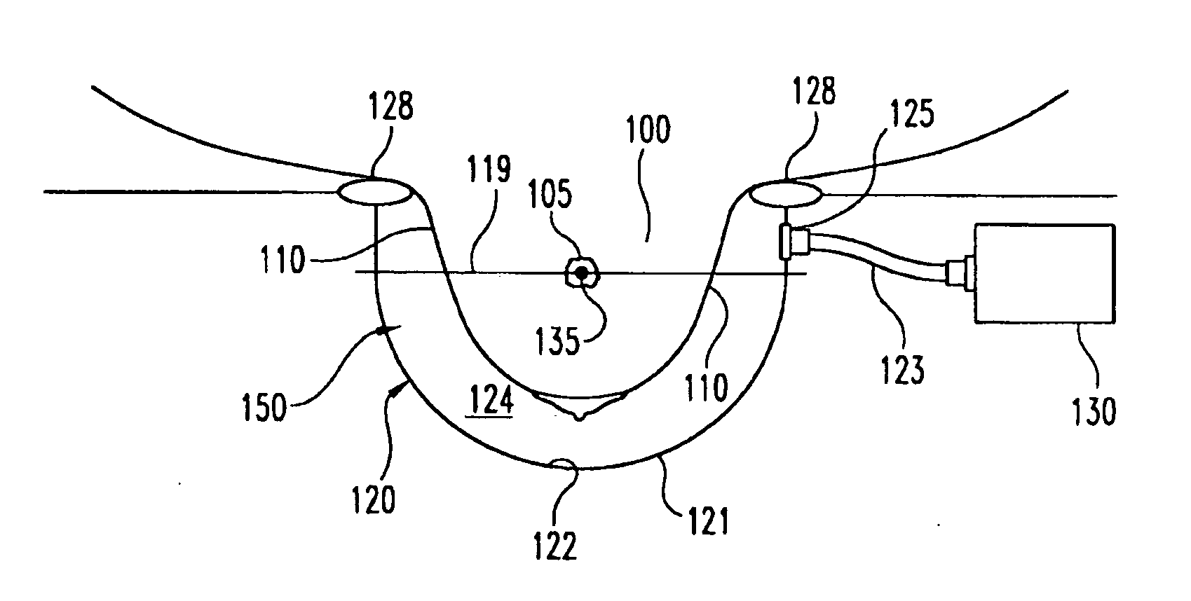 Apparatus and method for the treatment of breast cancer with particle beams