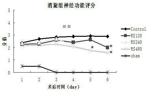 Novel application of oxiracetam or levo-oxiracetam in pharmaceutical field