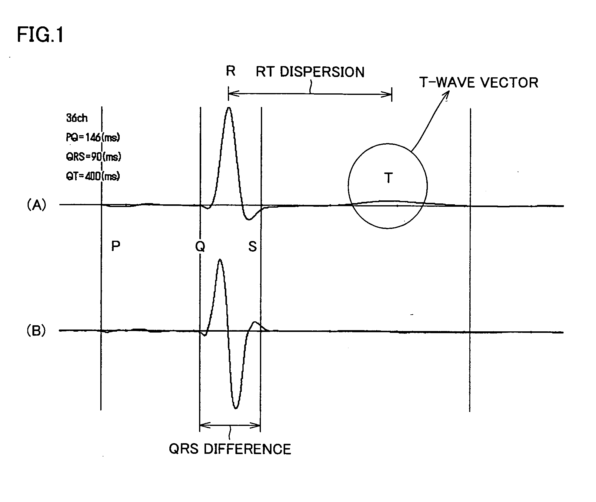 Cardiac Magnetic Field Diagnostic Apparatus and Evaluating Method of Three-Dimensional Localization of Myocardial Injury