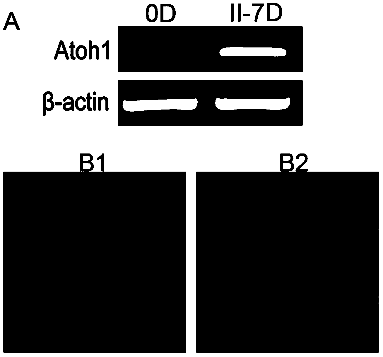 Method for induced differentiation of inner ear hair cells by virtue of human mesenchymal stem cells