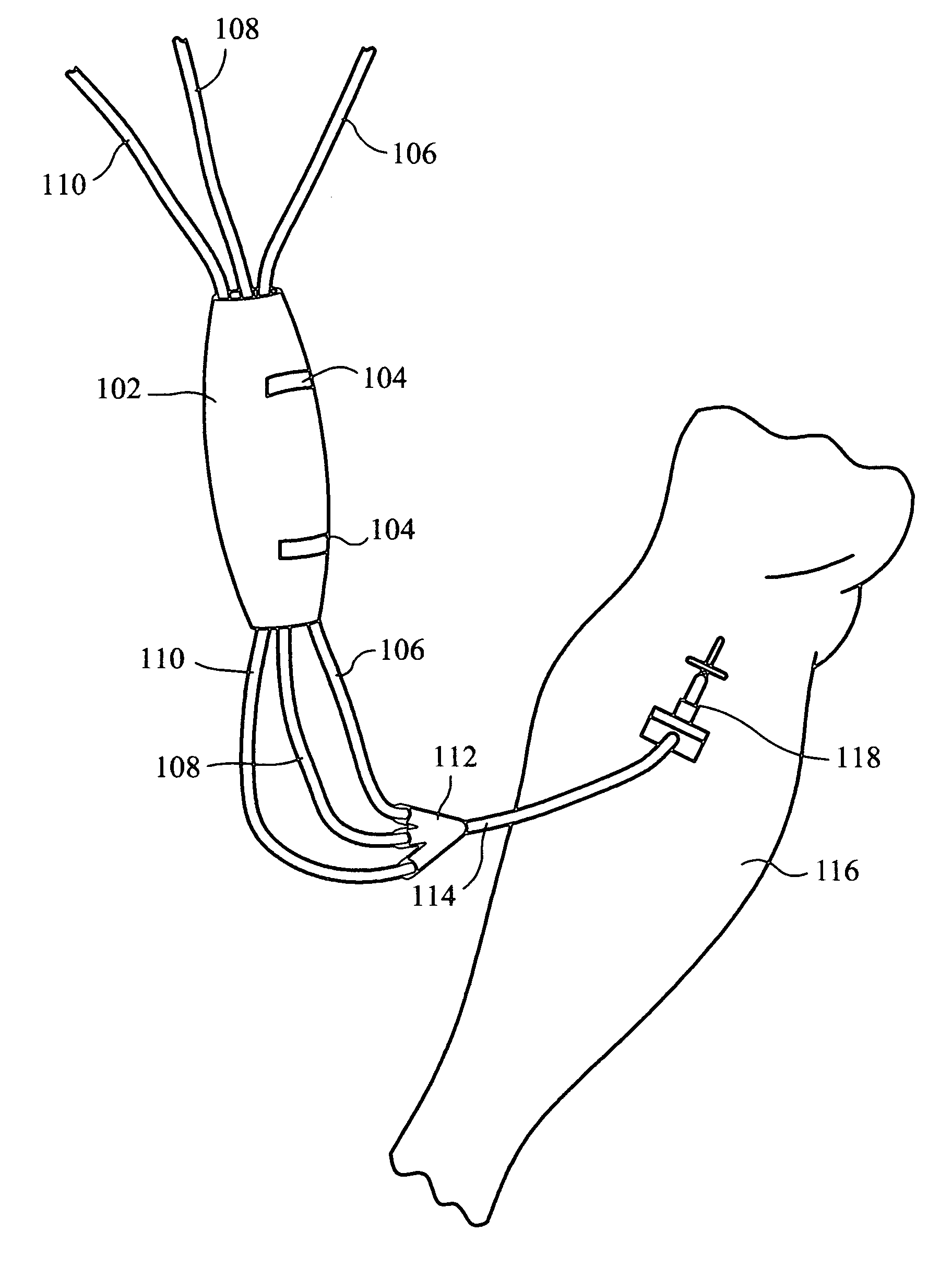 Intravenous tubing protector and support system