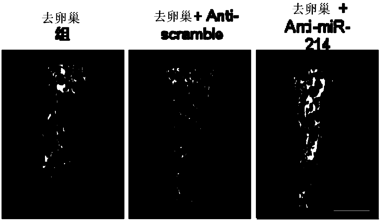 A peptide-based osteoblast targeting carrier and its preparation and application