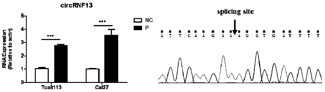 Application of reagents for detecting circular RNA circRNF13 in preparation of prognostic preparations for patients with tongue squamous cell carcinoma