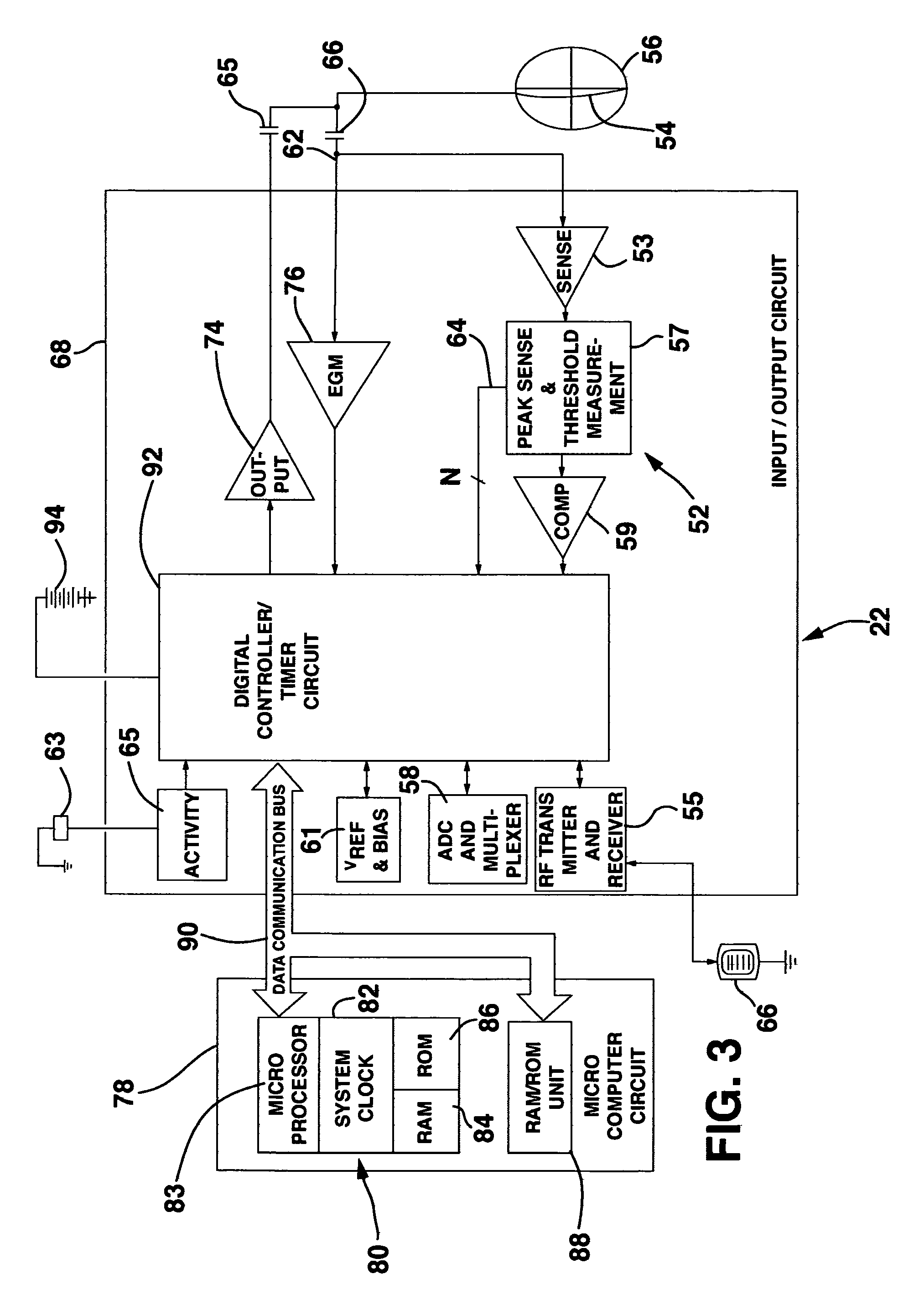 Method and system for myocardial infarction repair