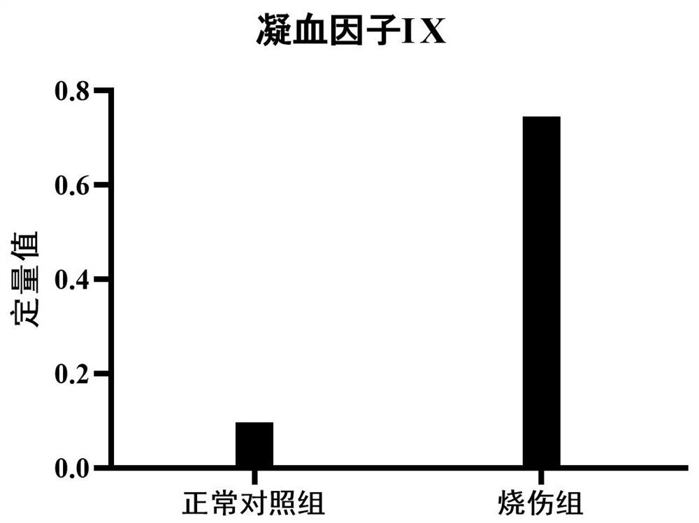 Urine blood coagulation factor IX and application of polypeptide fragment thereof in burns