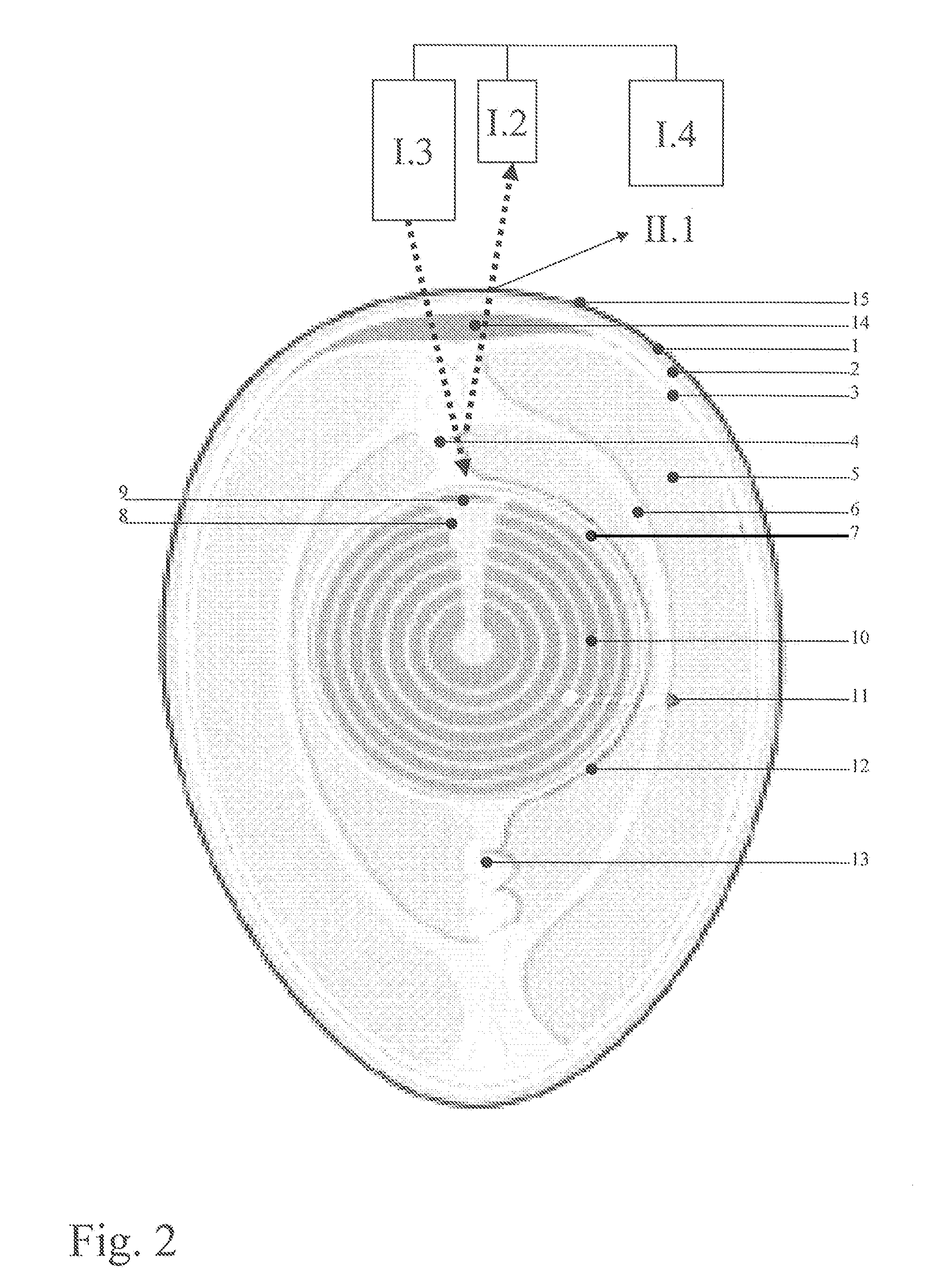 Method for avian sex determination