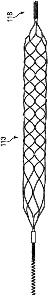 Blood flow restriction apparatus and method for embolus removal in human vasculature