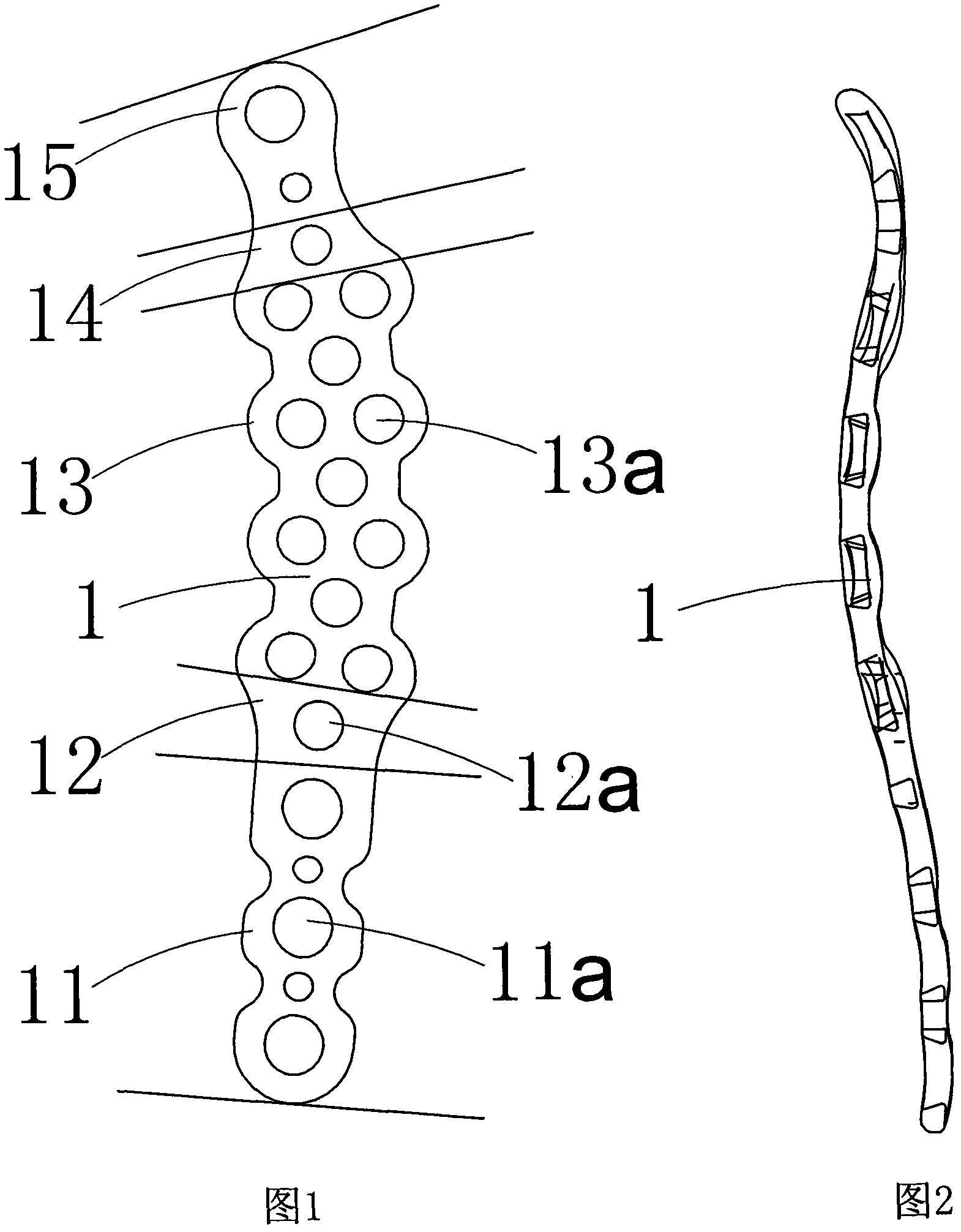 Semi-self-locking acetabulum posterior wall and posterior column anatomical plate