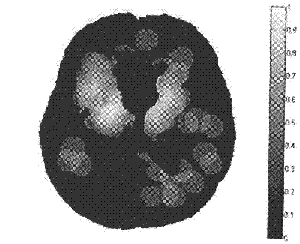 Computer-aided detection system for cerebral microbleeds based on magnetic resonance images