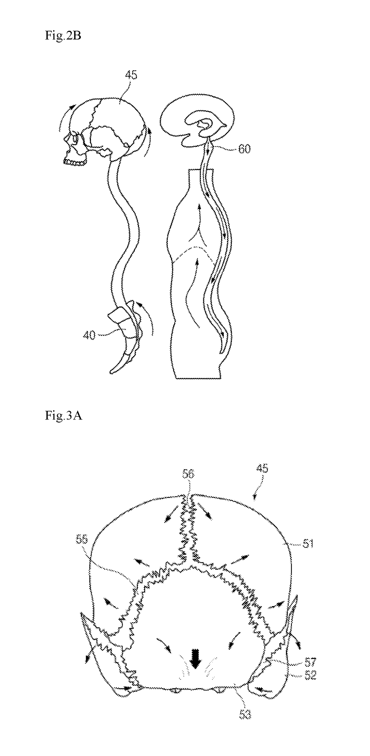 Functional pillow for manipulation therapy