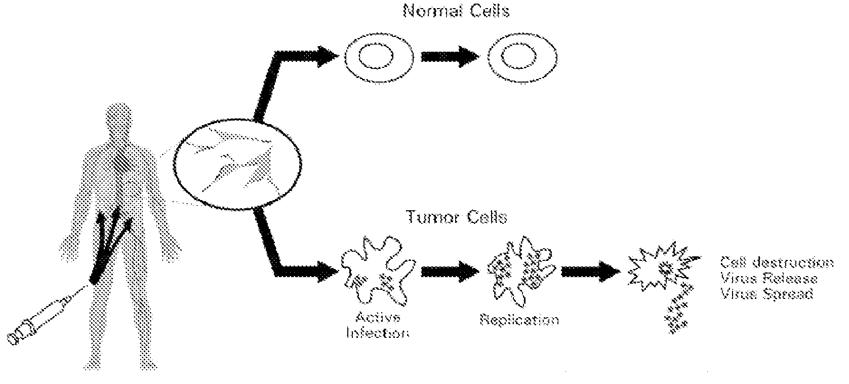 Seneca valley virus based compositions and methods for treating disease