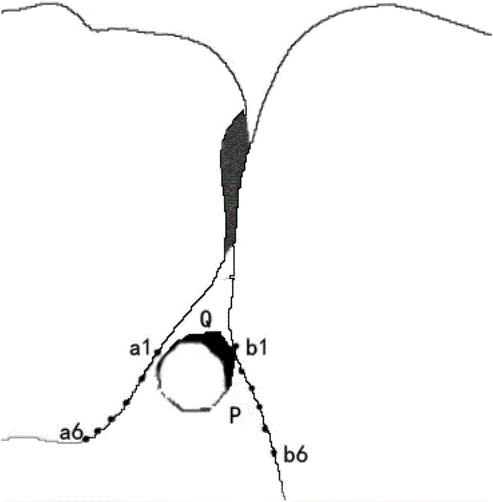 Digital gum line extracting method