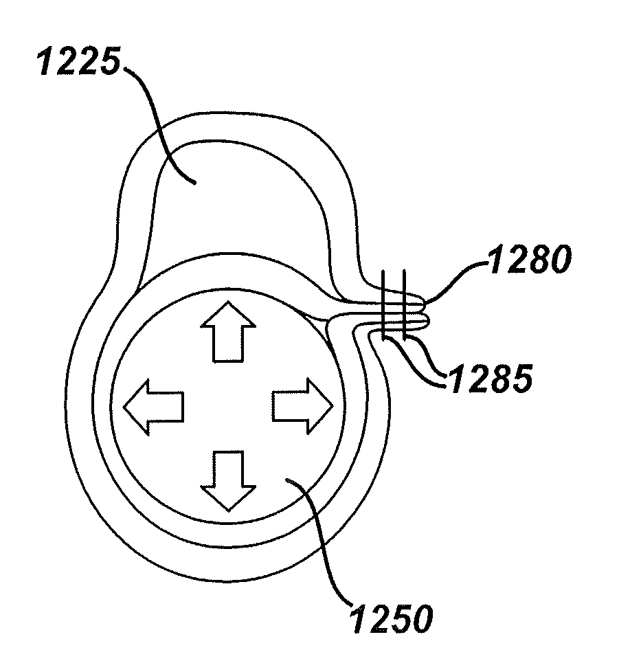 Systems and methods for gastric volume regulation