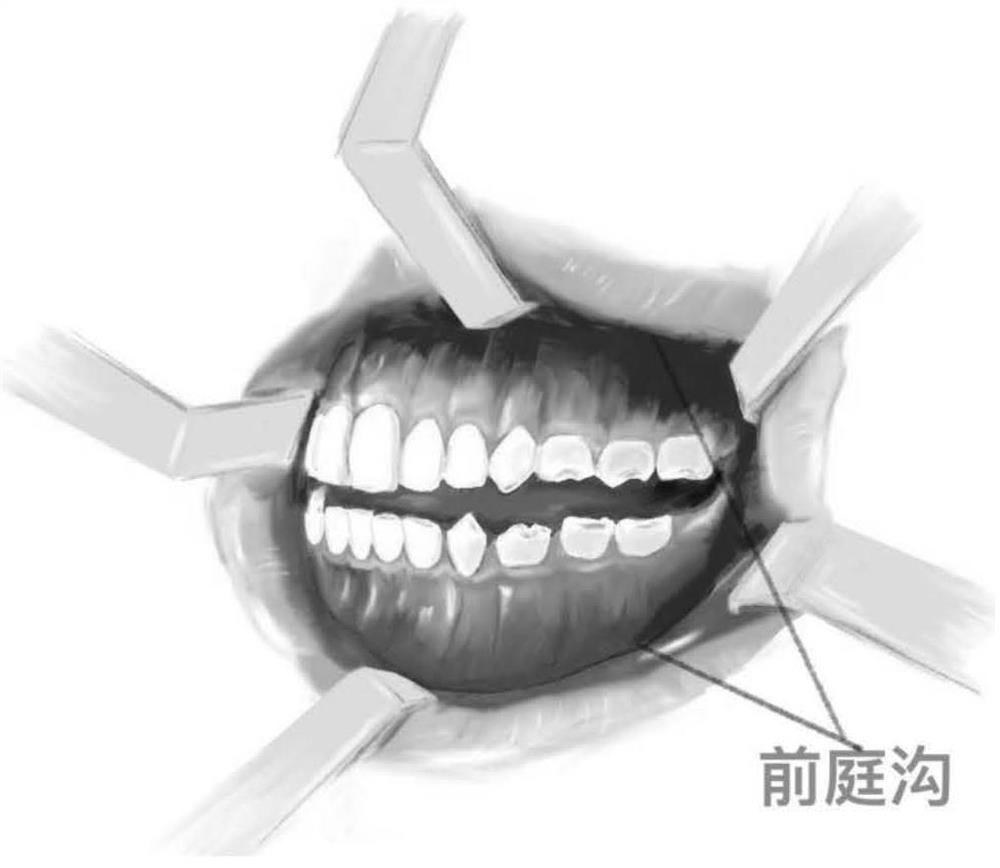 Application of oral bacterial liquid carrier