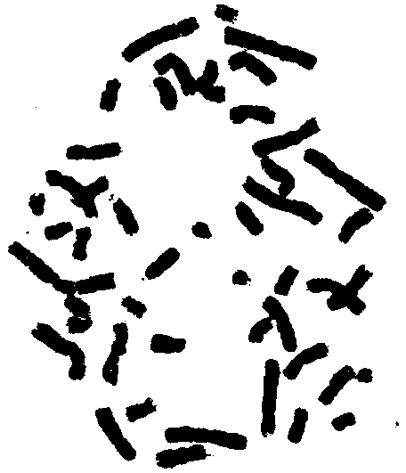 Preparation method of marrow G-band for karyotype analysis