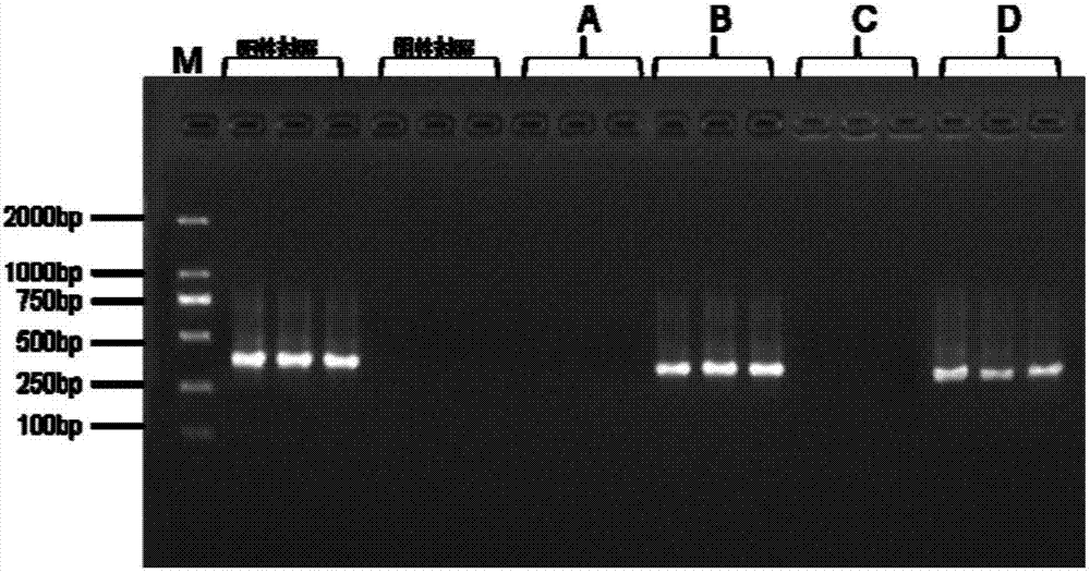 Human umbilical cord and placenta protection solution mycoplasma detection primer pair, kit and detection method thereof