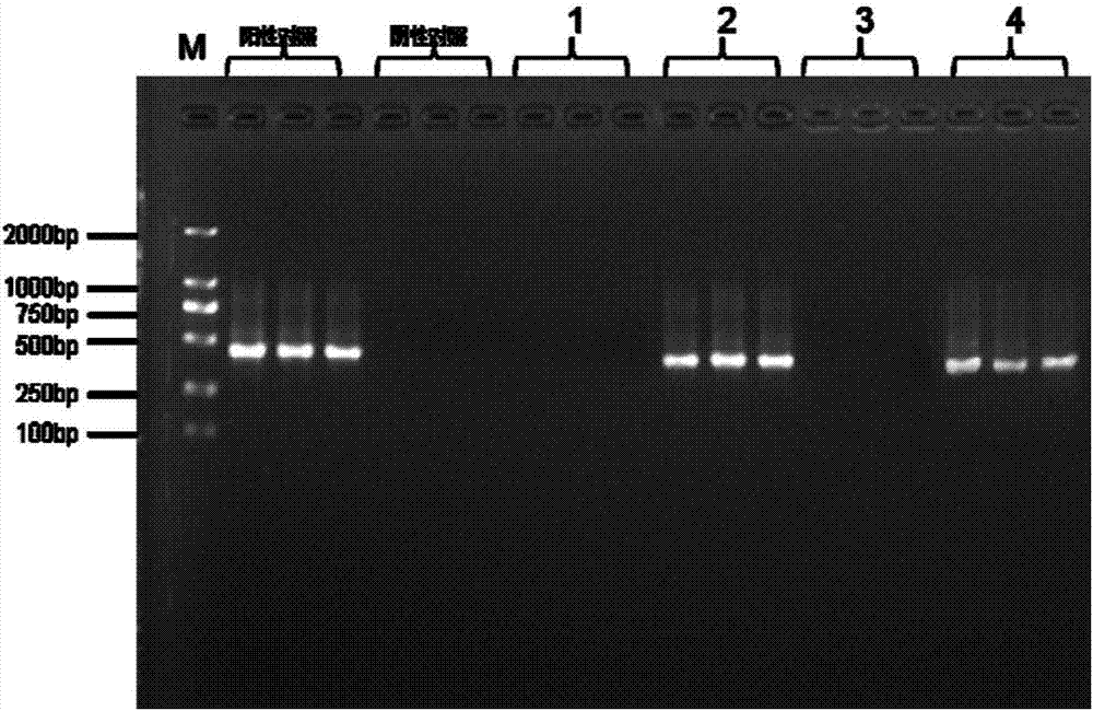 Human umbilical cord and placenta protection solution mycoplasma detection primer pair, kit and detection method thereof