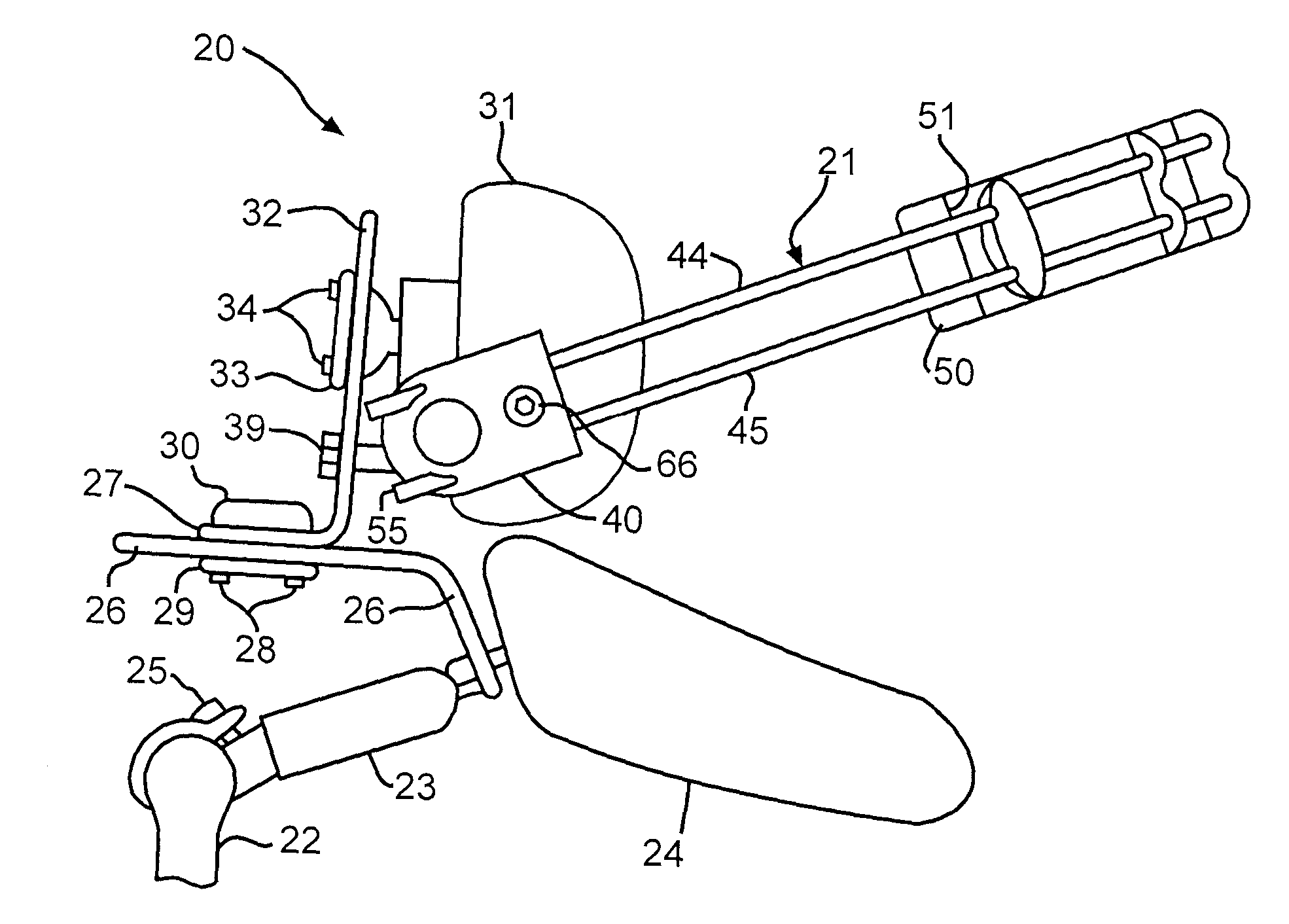 Semi-Rigid Anterior Head Alignment System