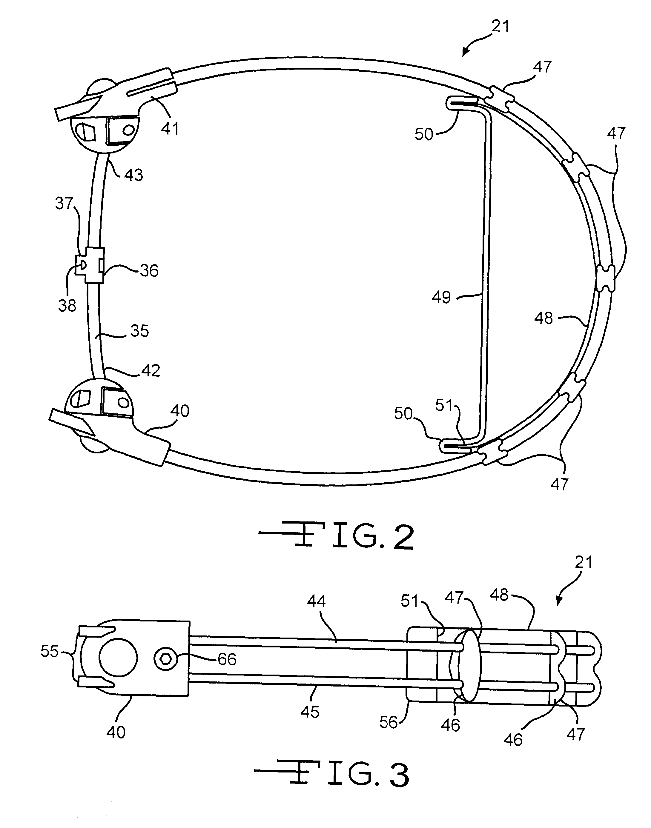 Semi-Rigid Anterior Head Alignment System