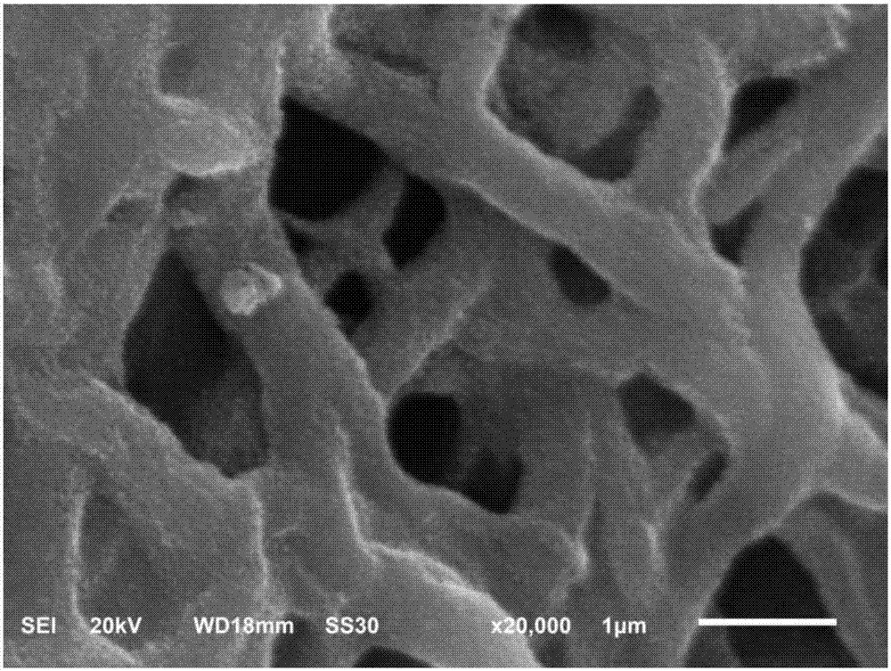 Chitosan-black phosphorus composite hydrogel and preparation method thereof