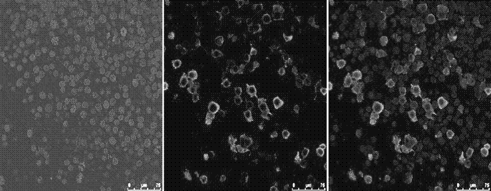 C9ORF135 gene, its encoding protein and application of antibody thereof